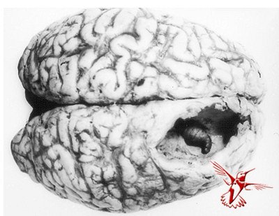 Желудочный овод в мозгу